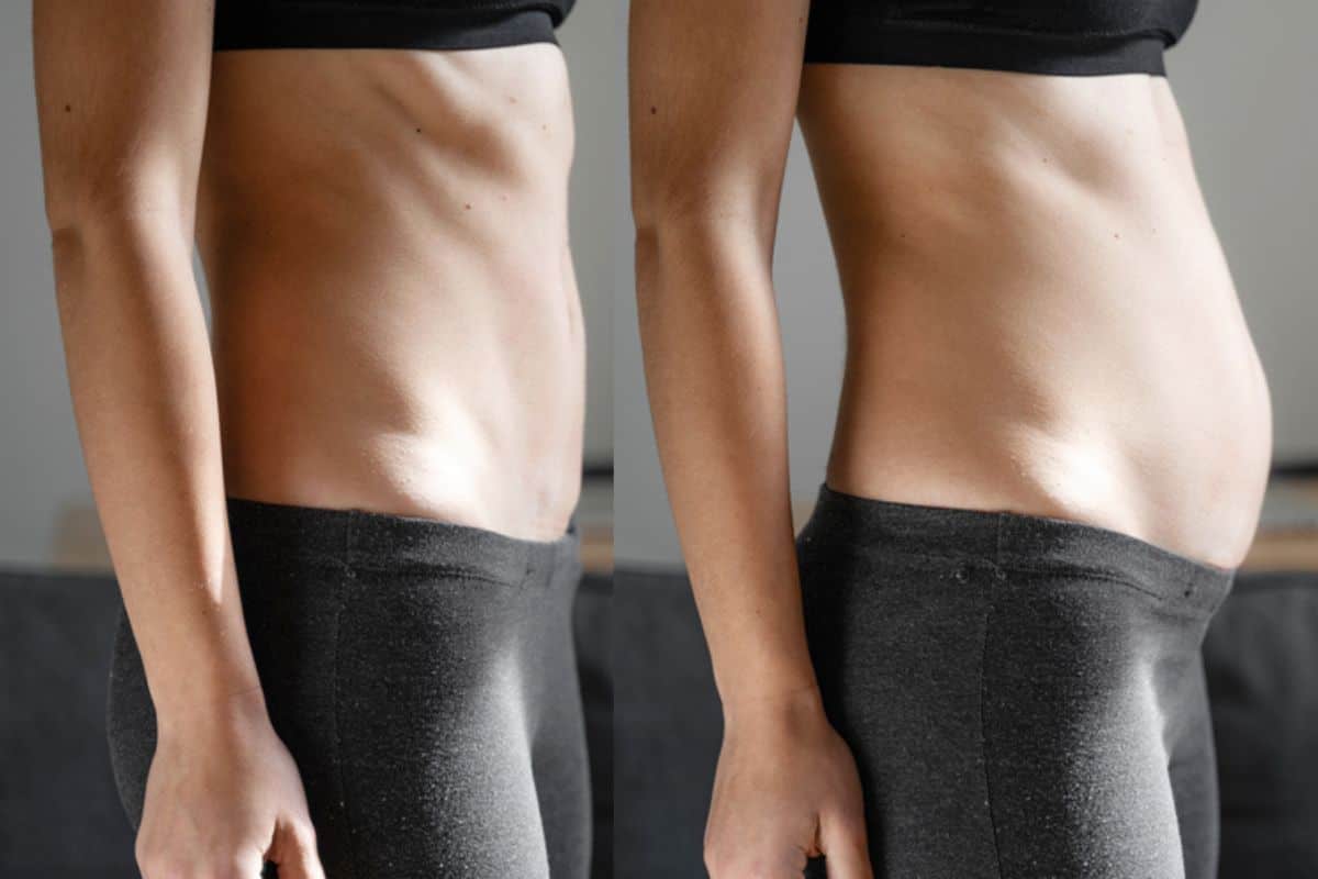 How long does diastasis recti take to improve Greater London (Ealing)?