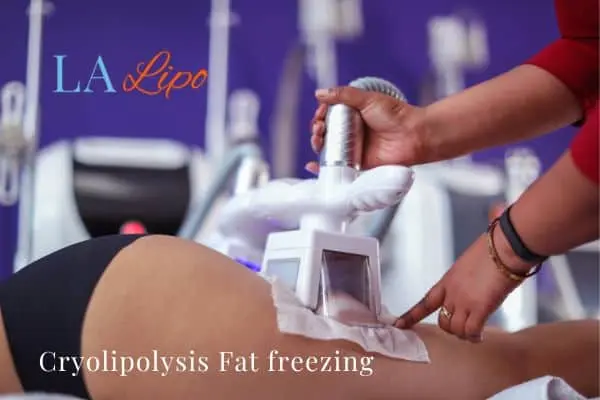 women getting fat freezing Greater London (Ealing)