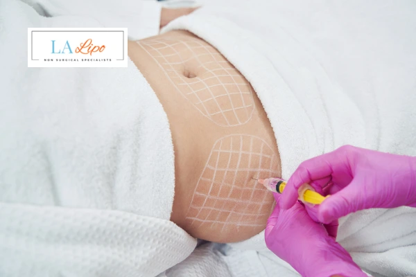 aqualyx fat dissolving injections Greater London (Ealing)