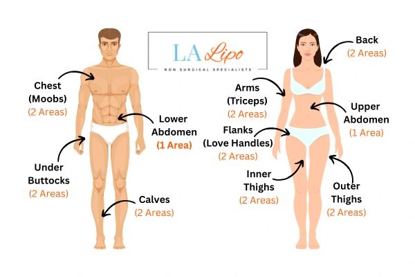 LA LIPO Cryolipolysis Areas Greater London (Ealing)