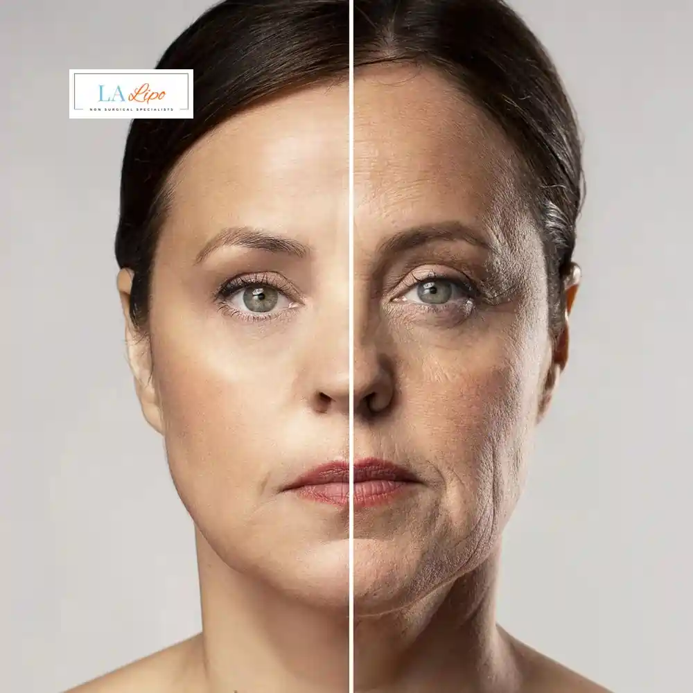 How Can You Tell If Non-Surgical Skin Tightening Is Right for You Greater London (Ealing)?
