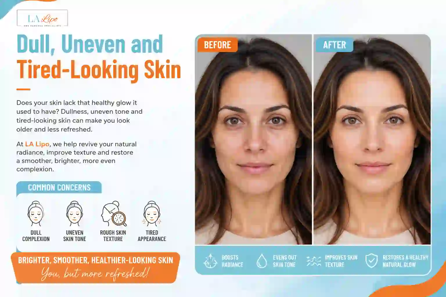 Sign #5: Dull, Uneven and Tired-Looking Skin Greater London (Ealing)