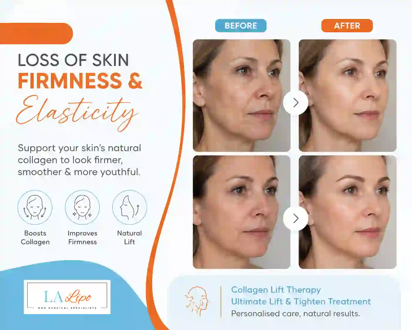 Sign #7: Loss of Skin Firmness and Elasticity Greater London (Ealing)